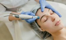 Rynkebehandling med laser og injeksjoner: Slik bremser du aldringsprosessen naturlig