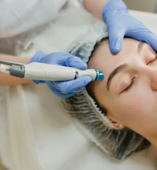 Rynkebehandling med laser og injeksjoner: Slik bremser du aldringsprosessen naturlig